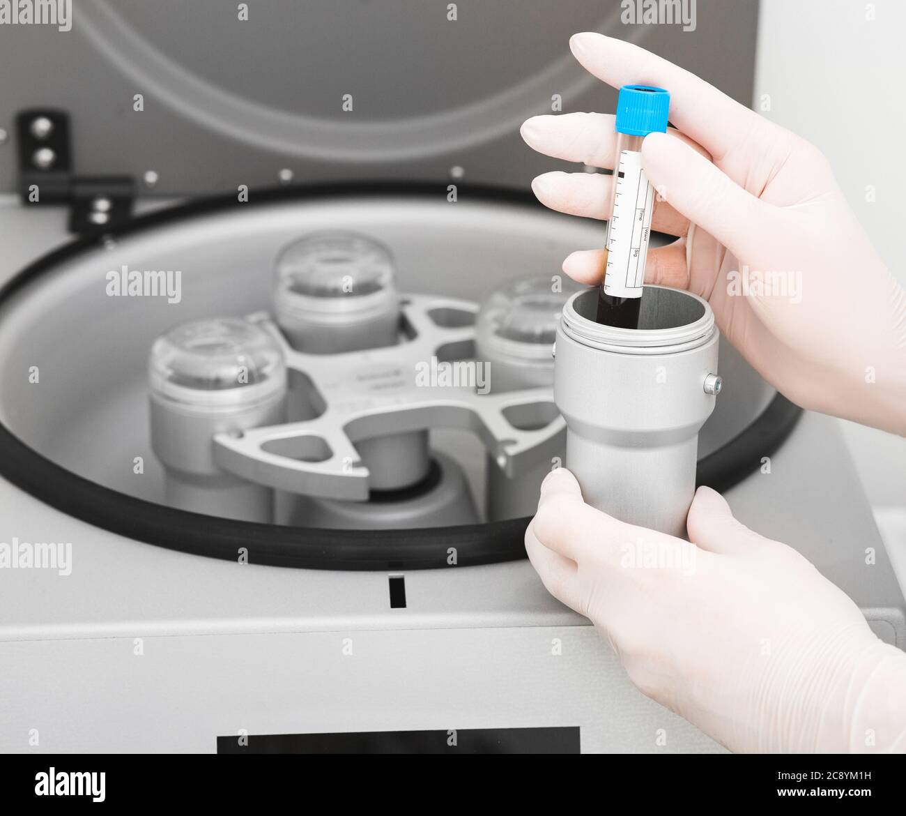 Plasmolifting process . Preparation of blood for injections ...