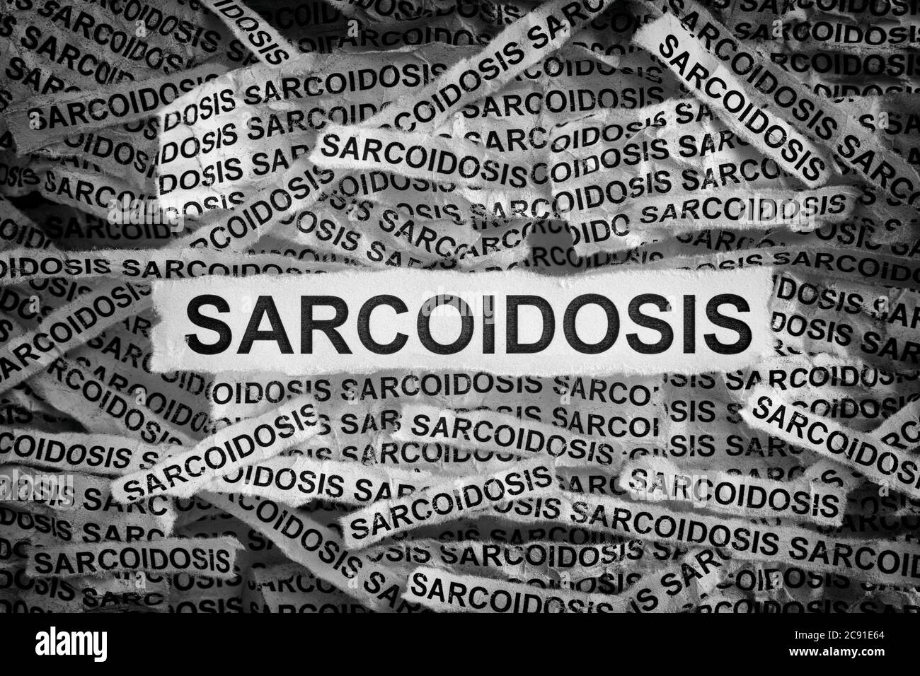 Sarcoidosis. Torn pieces of paper with the word Sarcoidosis. Concept Image. Black and white. Close up. Stock Photo