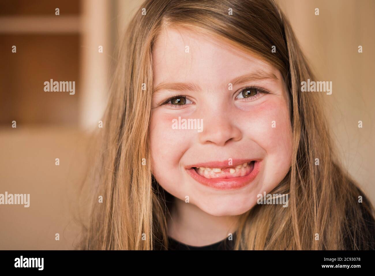 Closeup of a young girls mouth with missing teeth Stock Photo