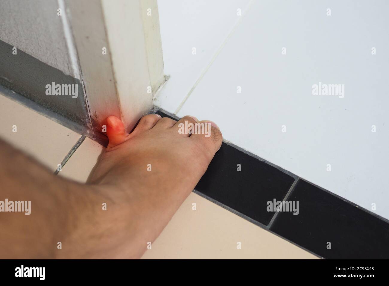 The little toe smacked against the door.- Little toe accident Stock Photo