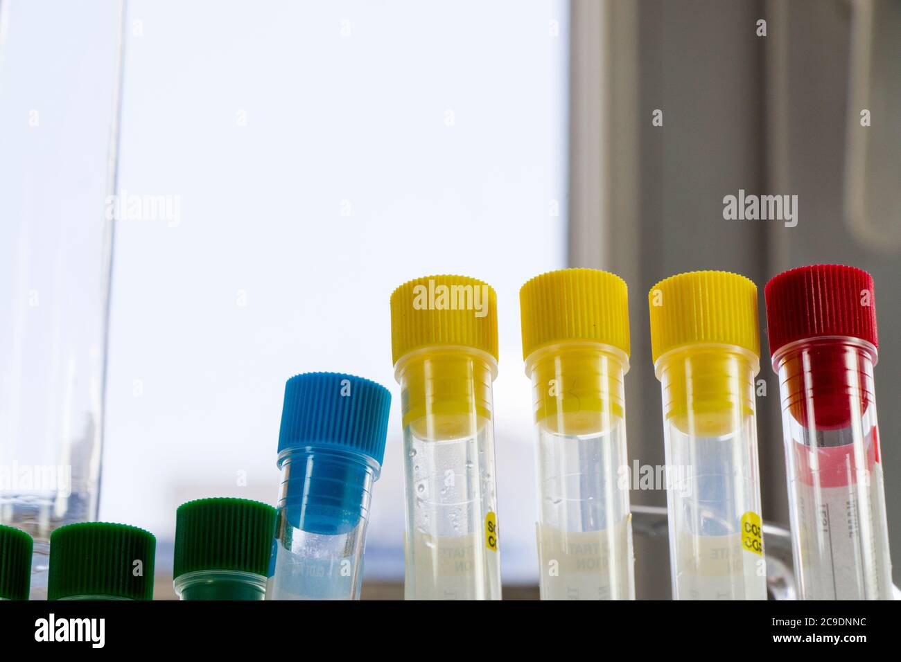 Laboratory blood test tube samples, research diagnoses, instruments and