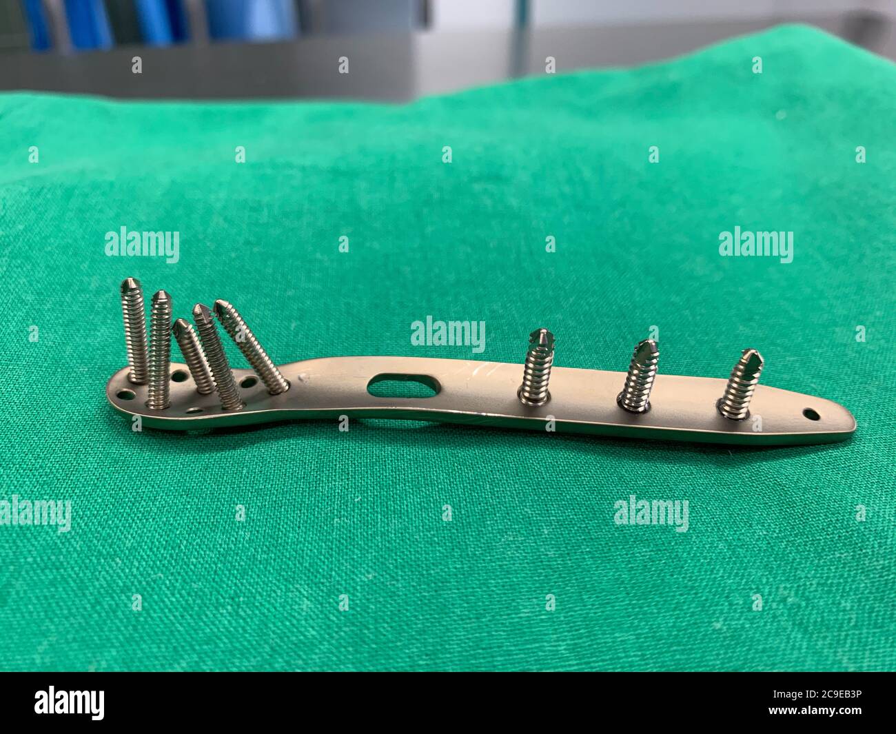 an explanted titanium plate with screws from an ankle fracture lies on a green surgical drape