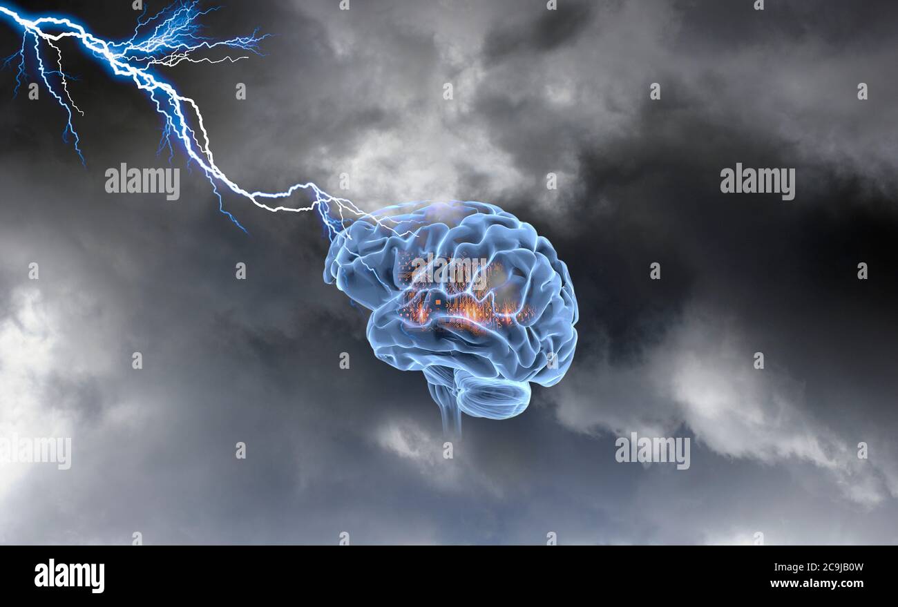 Artificial intelligence, conceptual image. Human brain with circuit ...