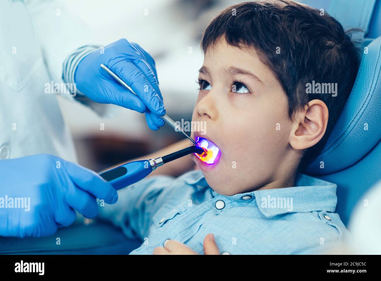 Dentist setting a filling with UV light Stock Photo Alamy