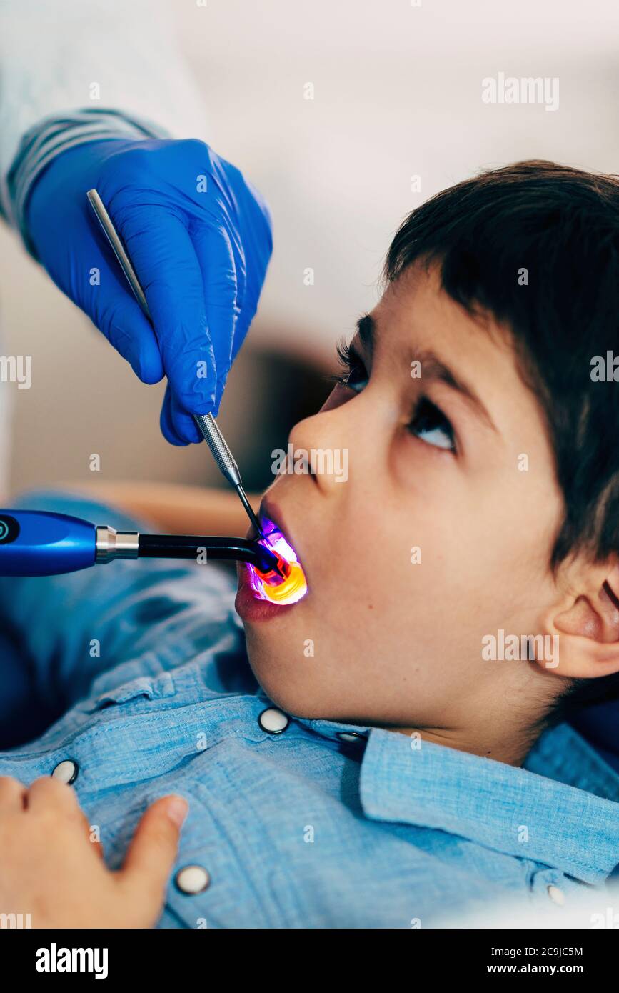 Dentist setting a filling with UV light Stock Photo Alamy