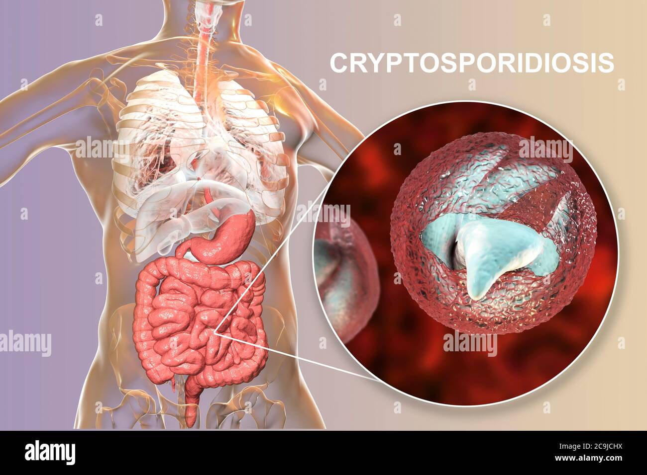 Cryptosporidium infection hi-res stock photography and images - Alamy