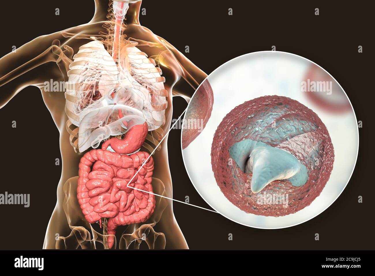 Cryptosporidium parvum parasites, the cause of cryptosporidiosis, computer  illustration. The parasite develops in the protrusions (microvilli) of epit  Stock Photo - Alamy