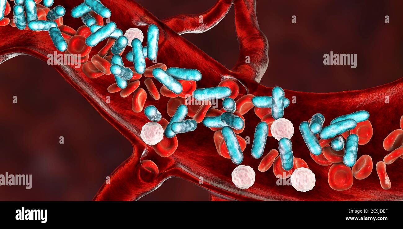 Bacterial blood infection, computer illustration. Stock Photo
