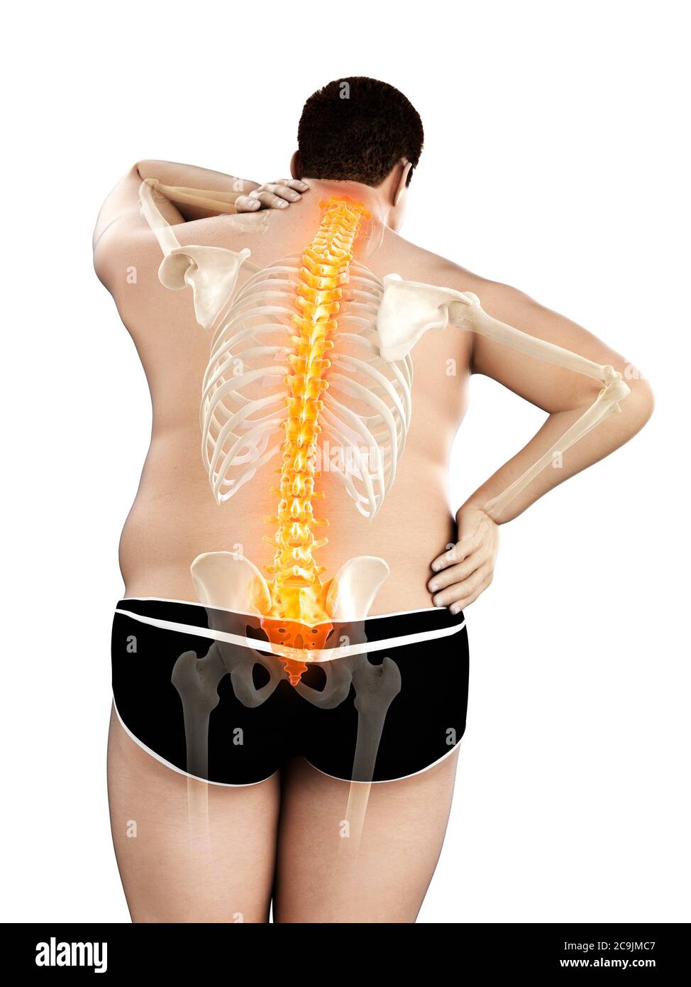 Obese man with back pain, computer illustration Stock Photo - Alamy