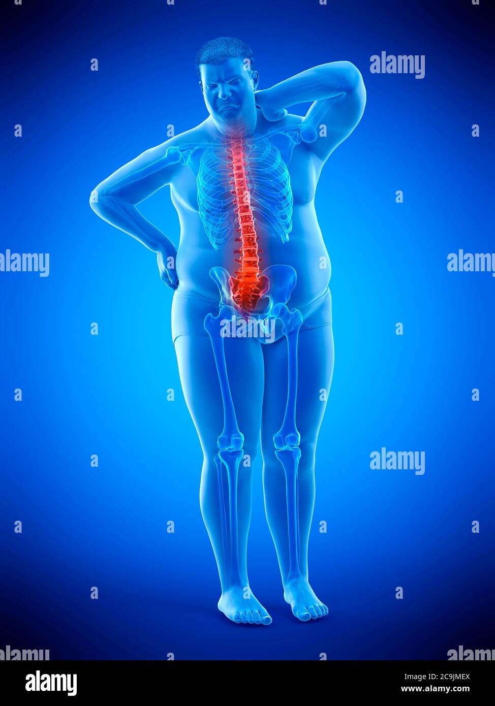 Obese man with back pain, computer illustration. Stock Photo