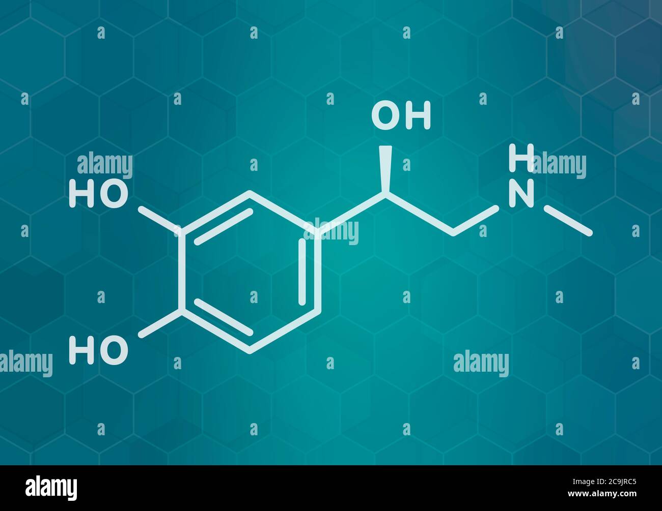 Adrenal pheochromocytoma hires stock photography and images Alamy