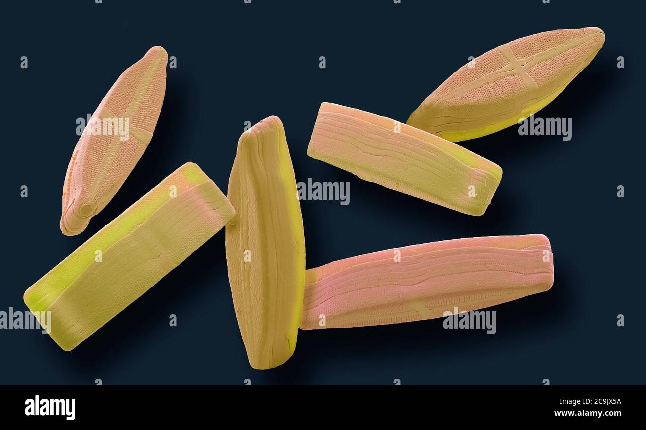 Diatoms. Coloured scanning electron micrograph (SEM) of diatoms. The diatoms are a group of photosynthetic, single-celled algae containing about 10, 0 Stock Photo