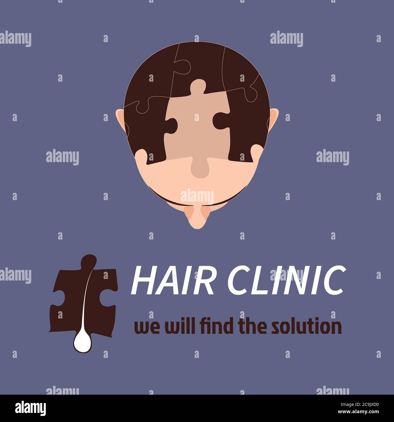 Hair loss treatment, conceptual illustration. Stock Photo