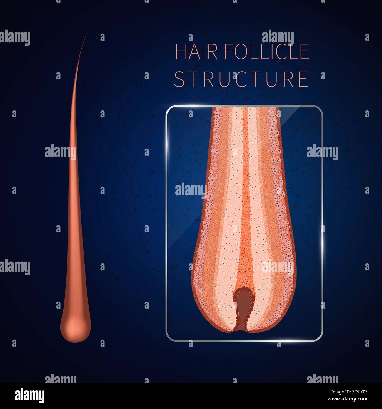 Hair follicle, illustration. Stock Photo