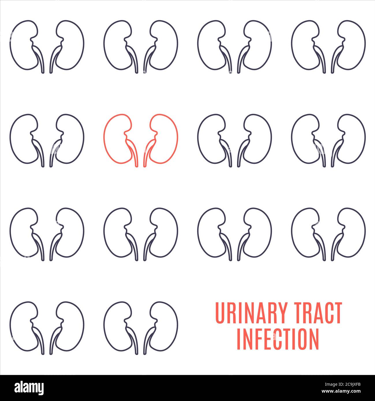 Urinary tract infection, conceptual illustration. Stock Photo