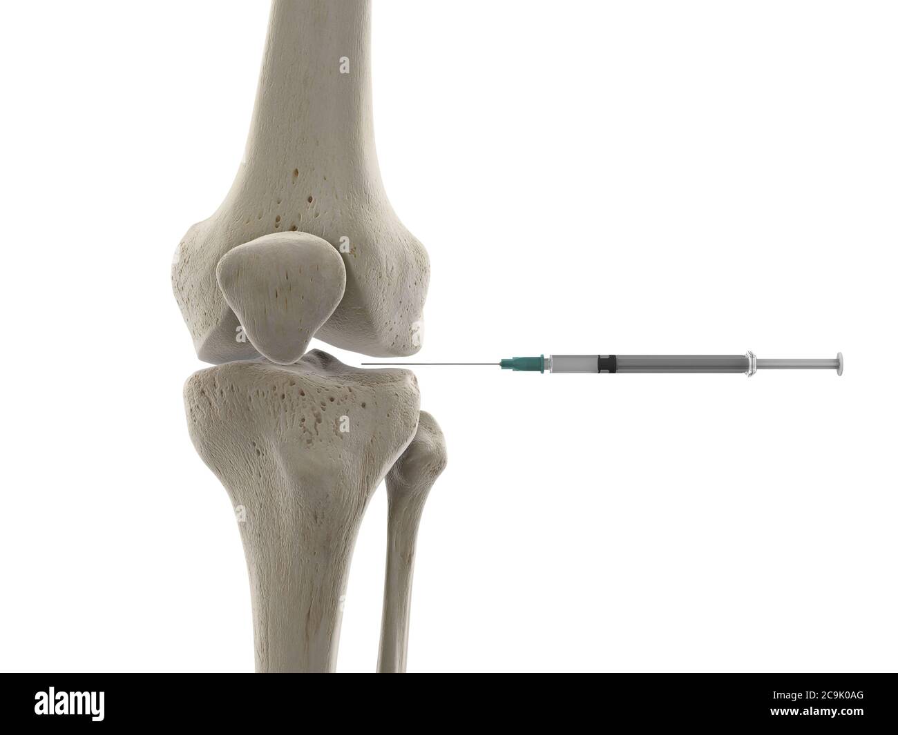 Knee joint injection Cut Out Stock Images & Pictures Alamy