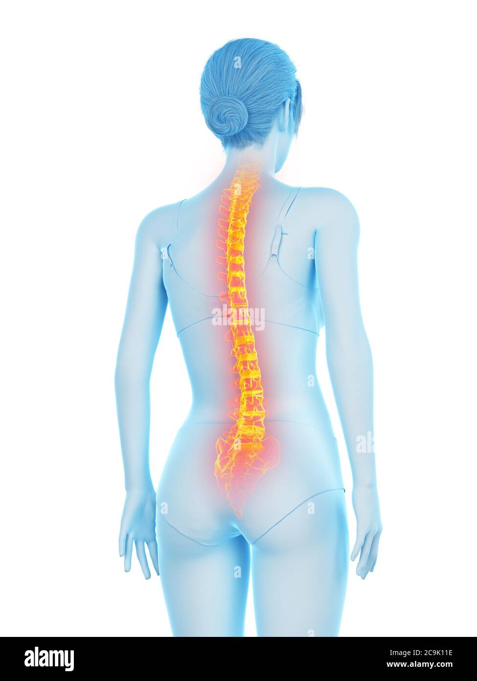 Woman with backache, illustration Stock Photo - Alamy