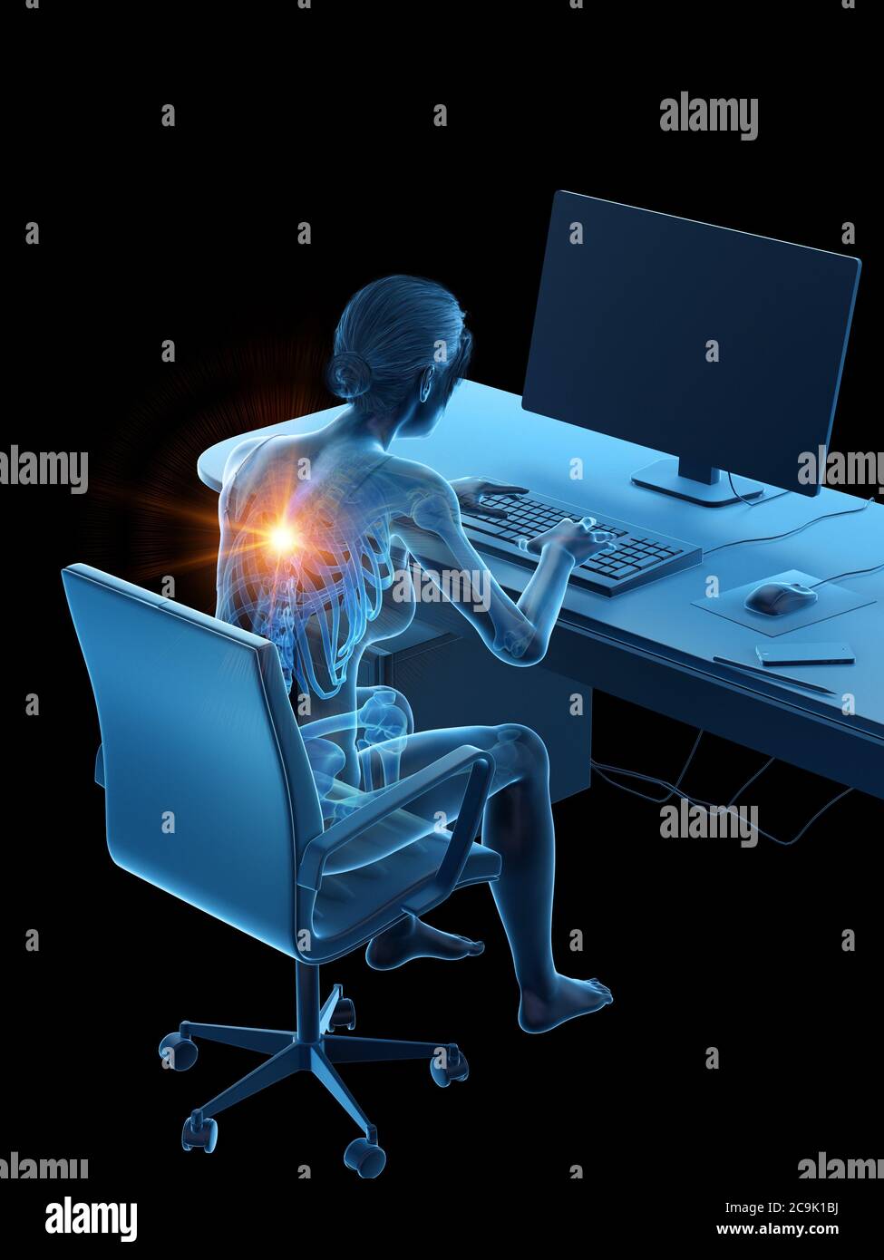 Woman with a painful back while working, illustration Stock Photo - Alamy