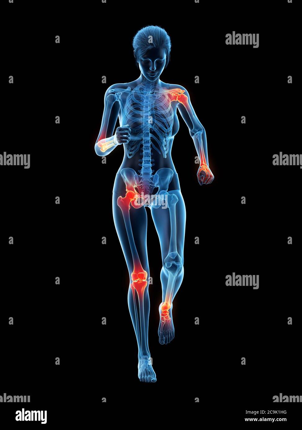 Woman with painful joints while walking, illustration Stock Photo Alamy