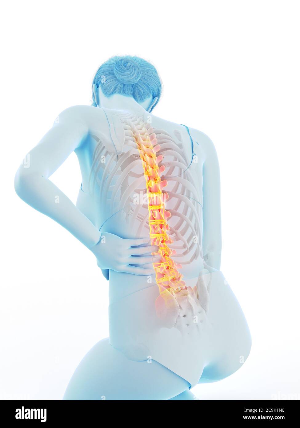 Woman having pain, muscle or chronic nerve pain in her back, sitting on  chair. Diseases of musculoskeletal system, spine, scoliosis, osteoporosis  Stock Photo - Alamy