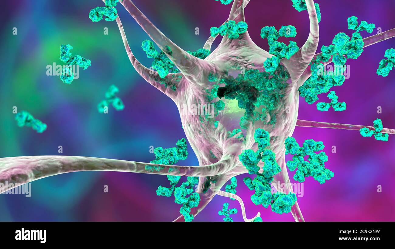 Antibodies attacking neurons. Conceptual computer illustration of autoimmune neurologic diseases. Stock Photo