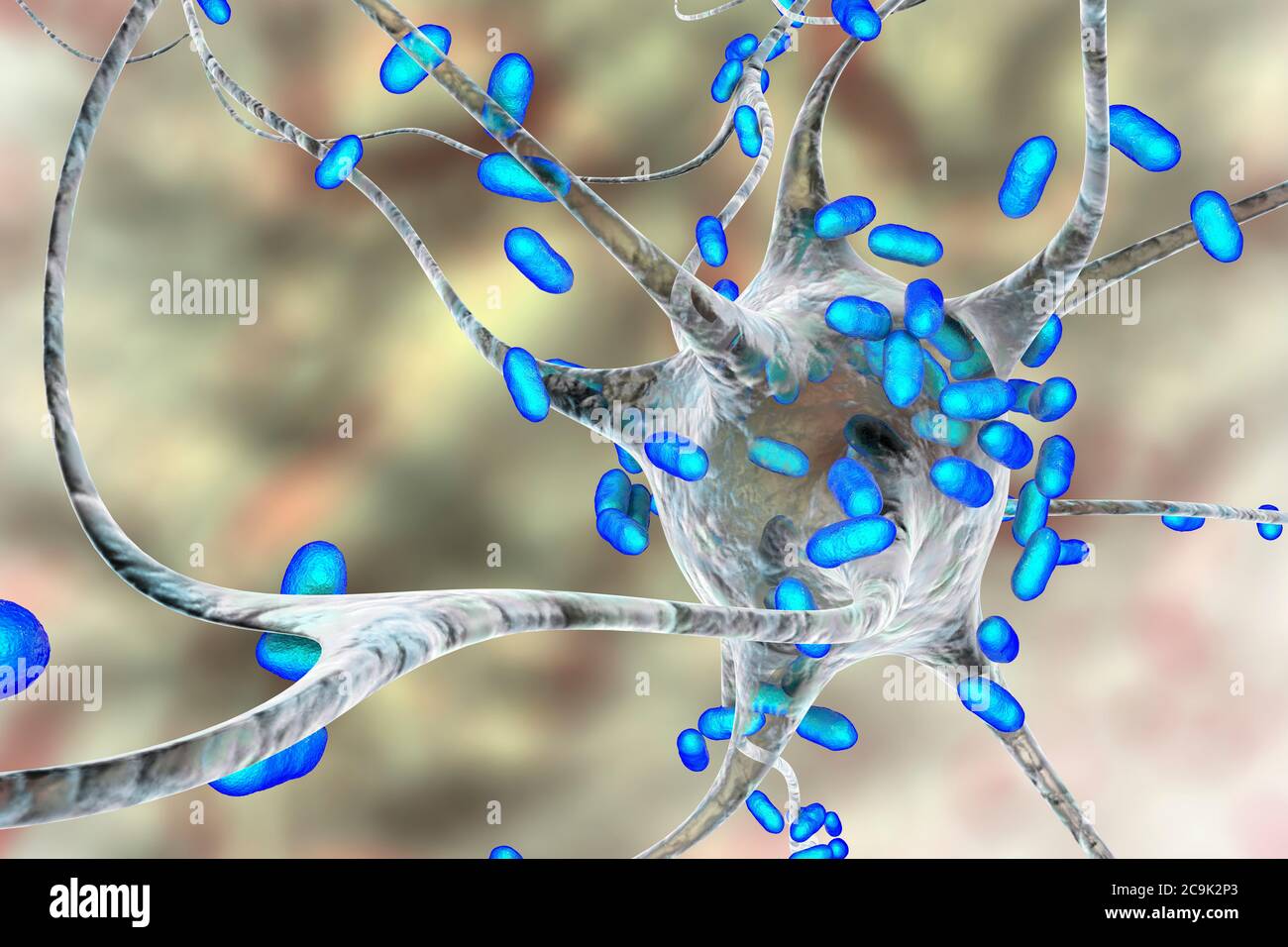Bacterial encephalitis. Conceptual computer illustration showing bacteria infecting brain cells. Stock Photo
