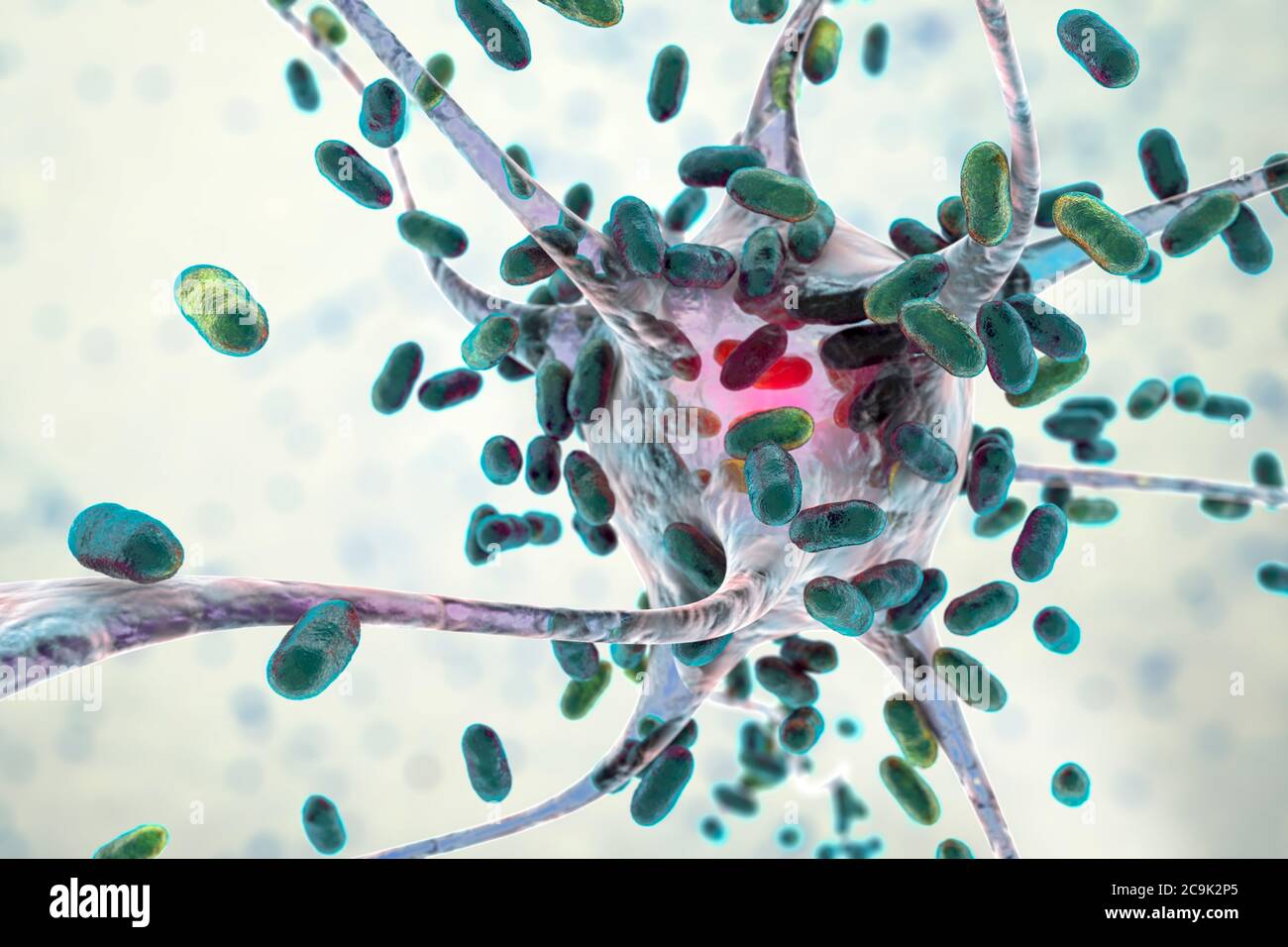 Bacterial Encephalitis Conceptual Computer Illustration Showing   Bacterial Encephalitis Conceptual Computer Illustration Showing Bacteria Infecting Brain Cells 2C9K2P5 