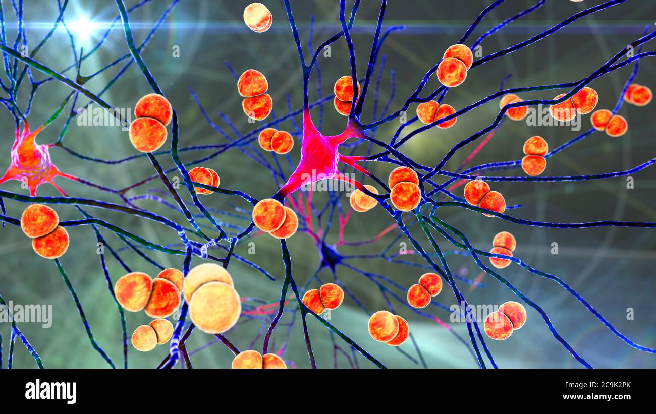 Bacterial brain infection. Conceptual computer illustration showing Streptococcus pneumoniae bacteria, one of the main causes of bacterial meningitis Stock Photo