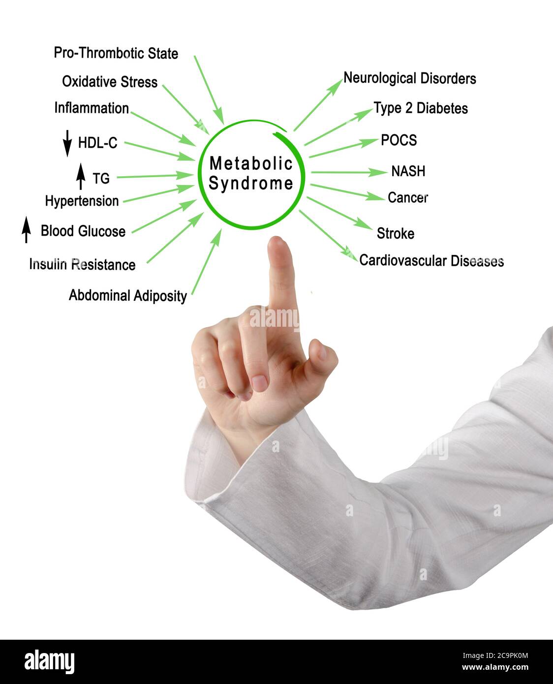 Woman presenting causes and effects of Metabolic Syndrome Stock Photo