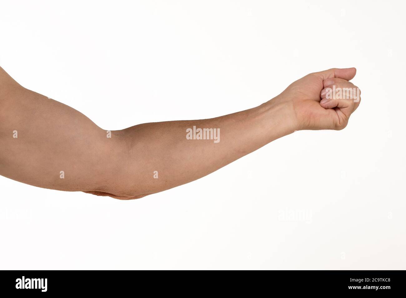 elbow restriction caused by Osteoarthritis Stock Photo Alamy