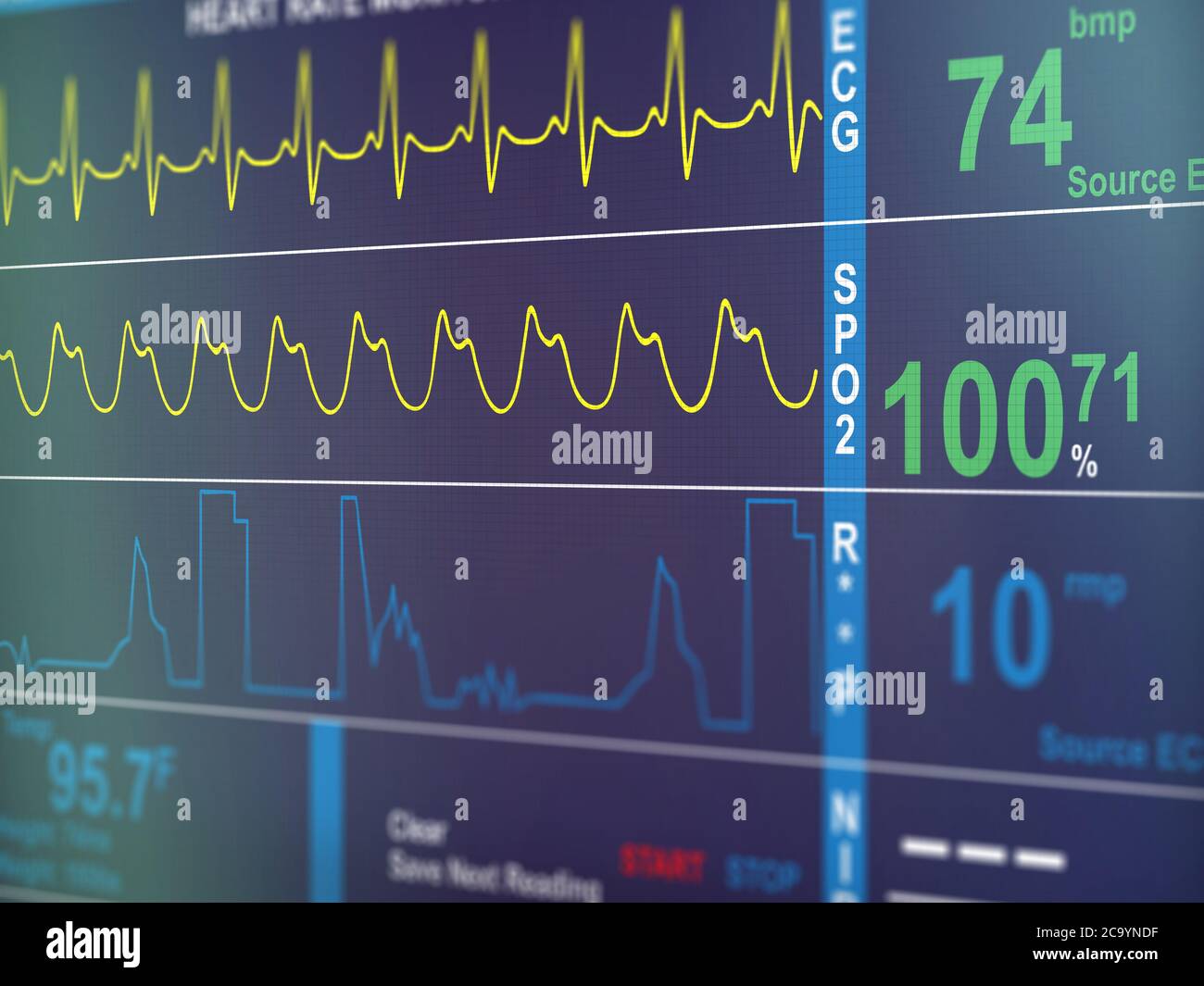 Cardiac frequency diagram Stock Photo Alamy