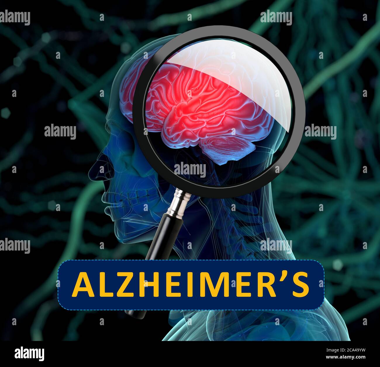 3D medical background with magnifying glass examining brain depicting ...