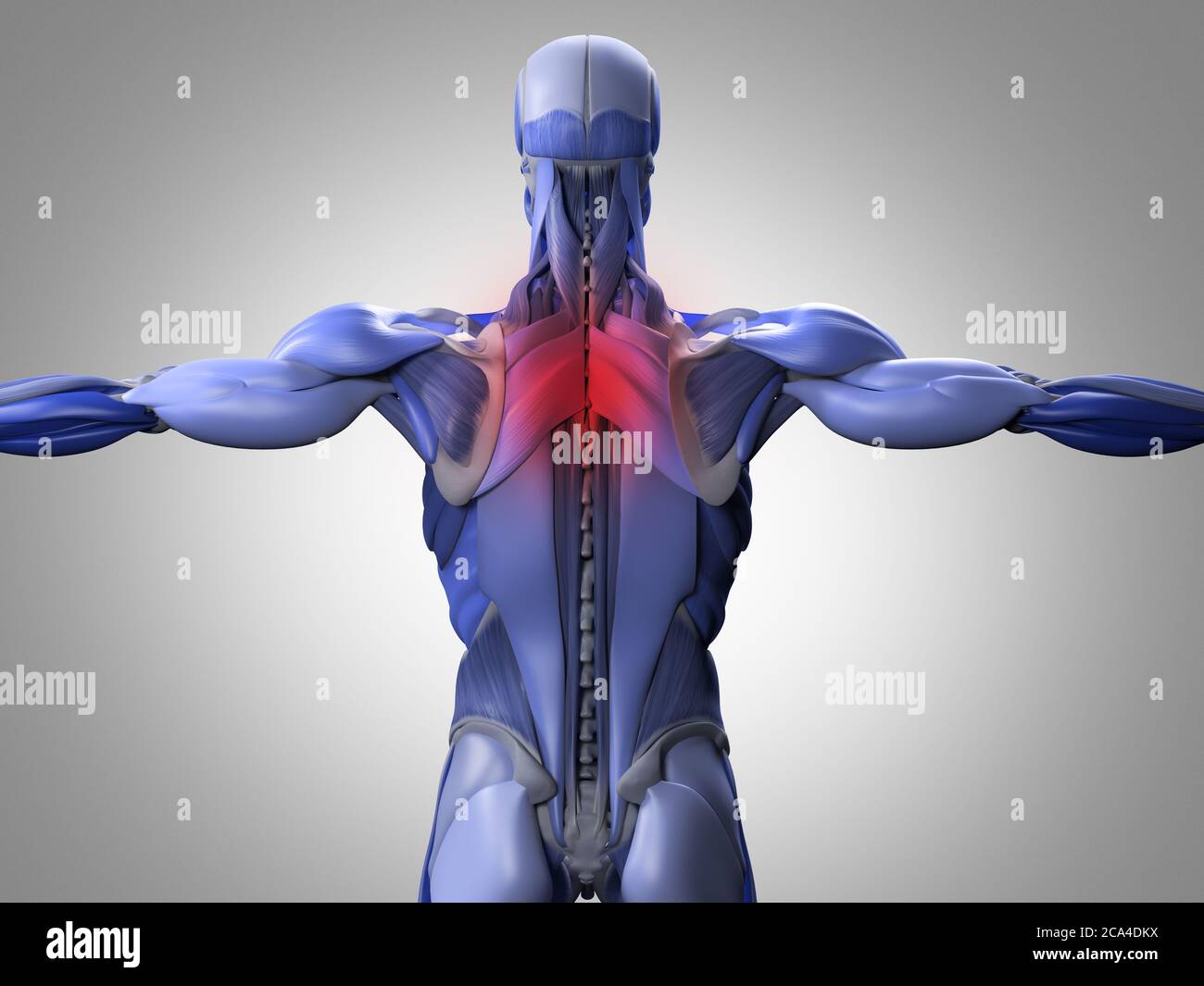 Anatomy Illustration Of Back Muscle Groups Showing Neck Pain 3d Illustration Stock Photo Alamy