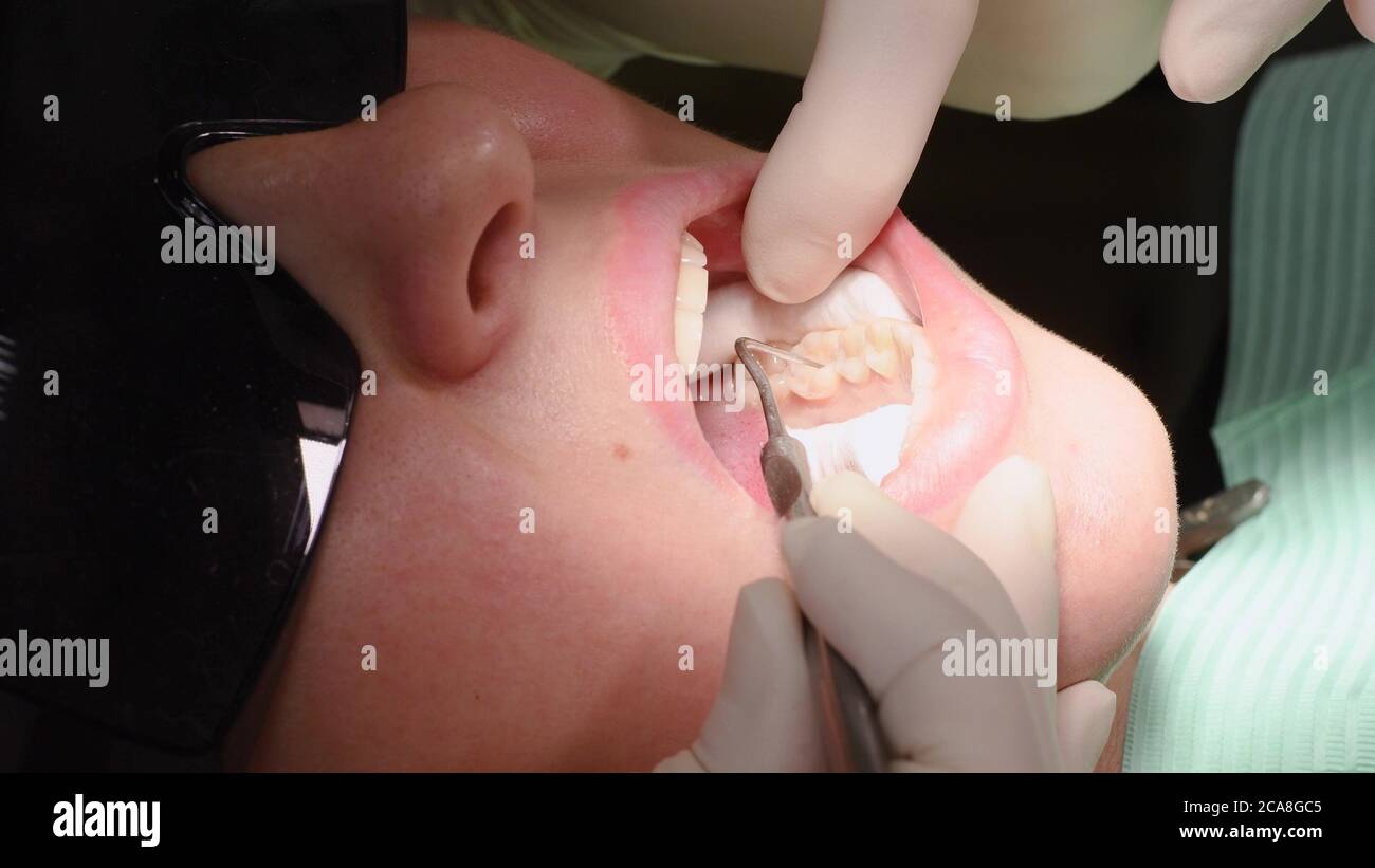 Young woman at dental clinic Stock Photo