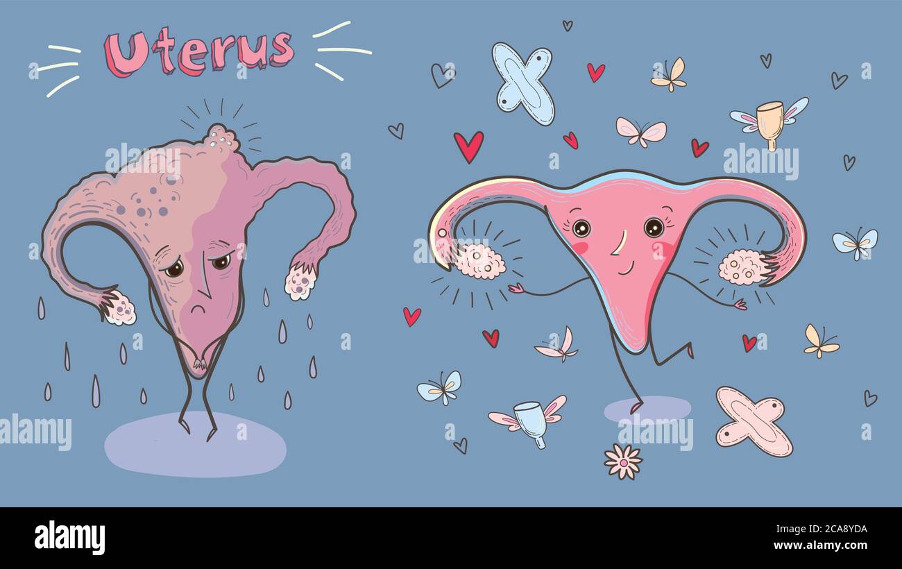 Cartoon vector illustration of healthy and sick uterus. Funny educational illustration. Stock Vector