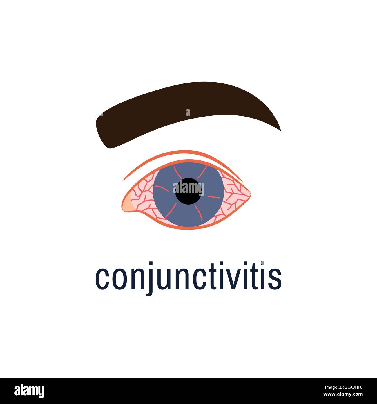 Conjunctivitis icon isolated on white. Eye disease Stock Vector