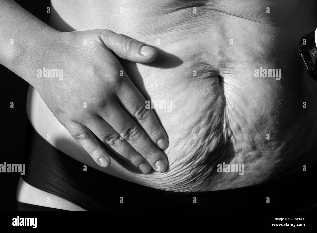Woman smears nutritious cream sagging flabby belly with stretch marks, close-up, black and white photo. Stock Photo