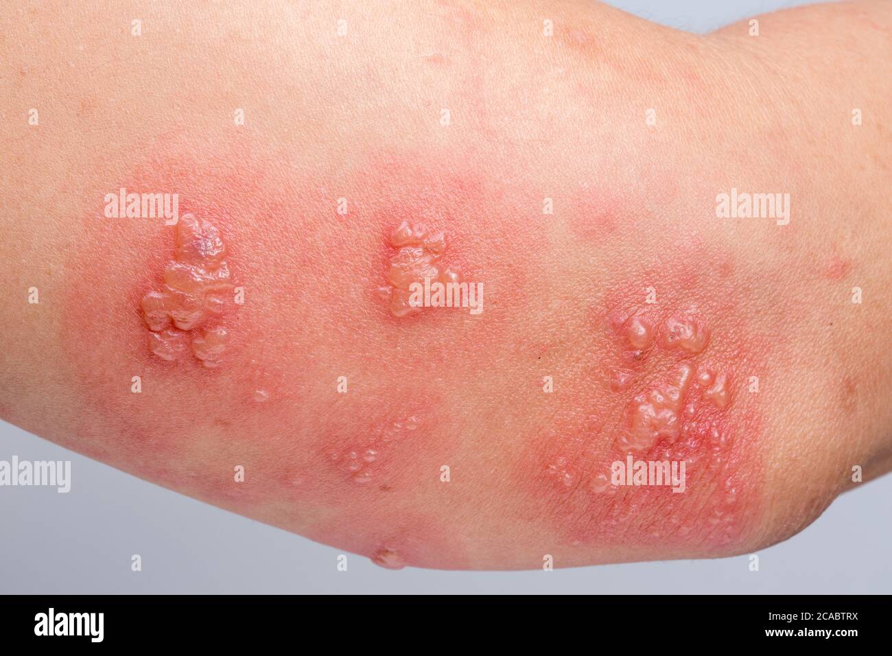 Dorsal root ganglion hires stock photography and images Alamy