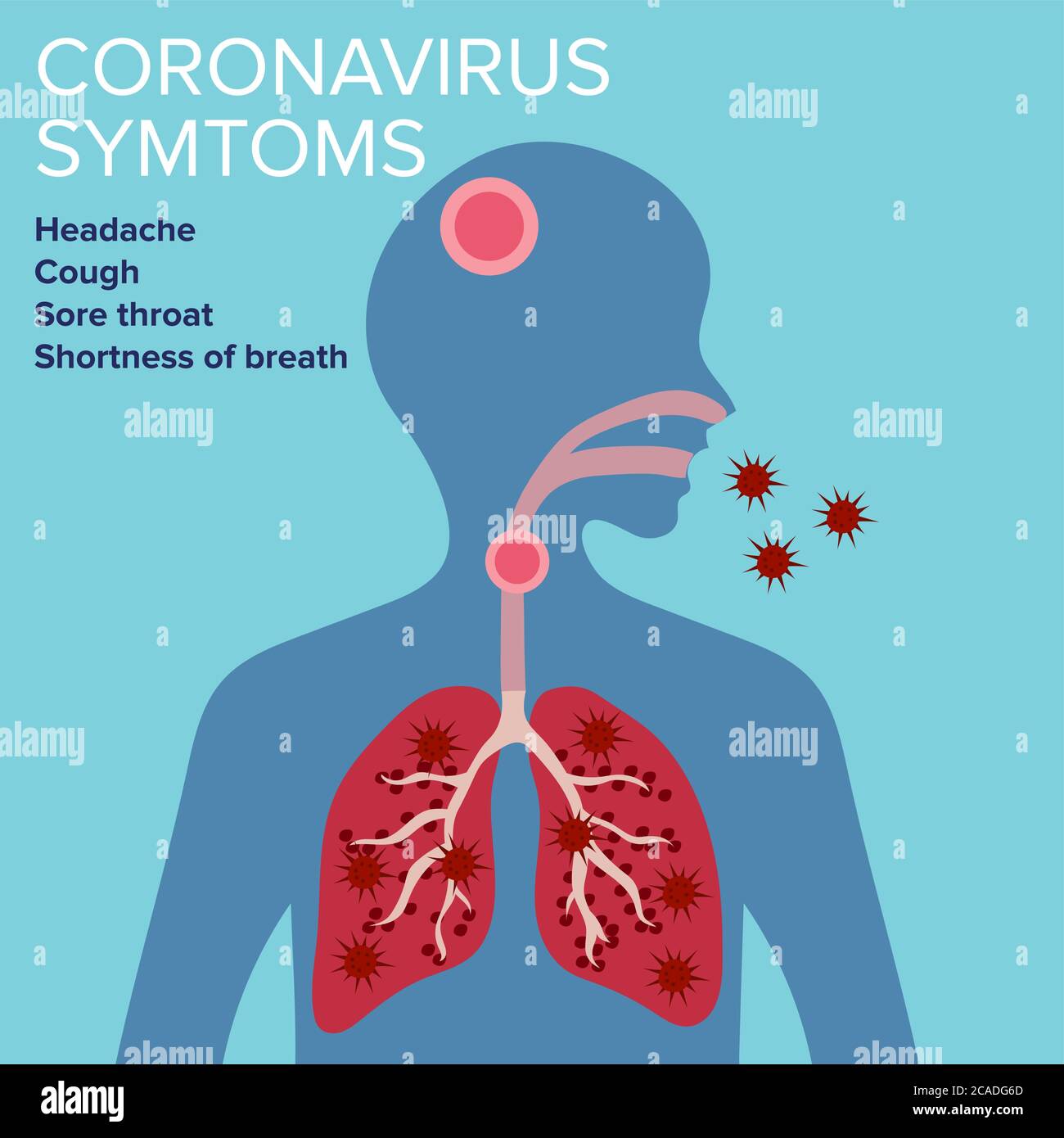 Sign Infographic with Cartoon has Cough, Fever, Sore Throat and Cold in Coronavirus or Covid-19 Outbreak. Stock Vector