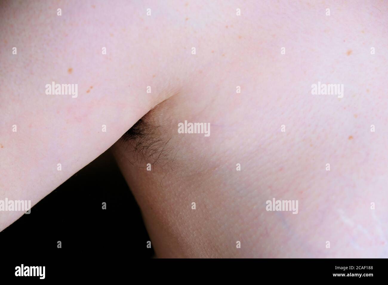 Woman showing hair growth in underarm; result of sheltering in place during the coronavirus quarantine; female with hairy unshaven armpit. Stock Photo