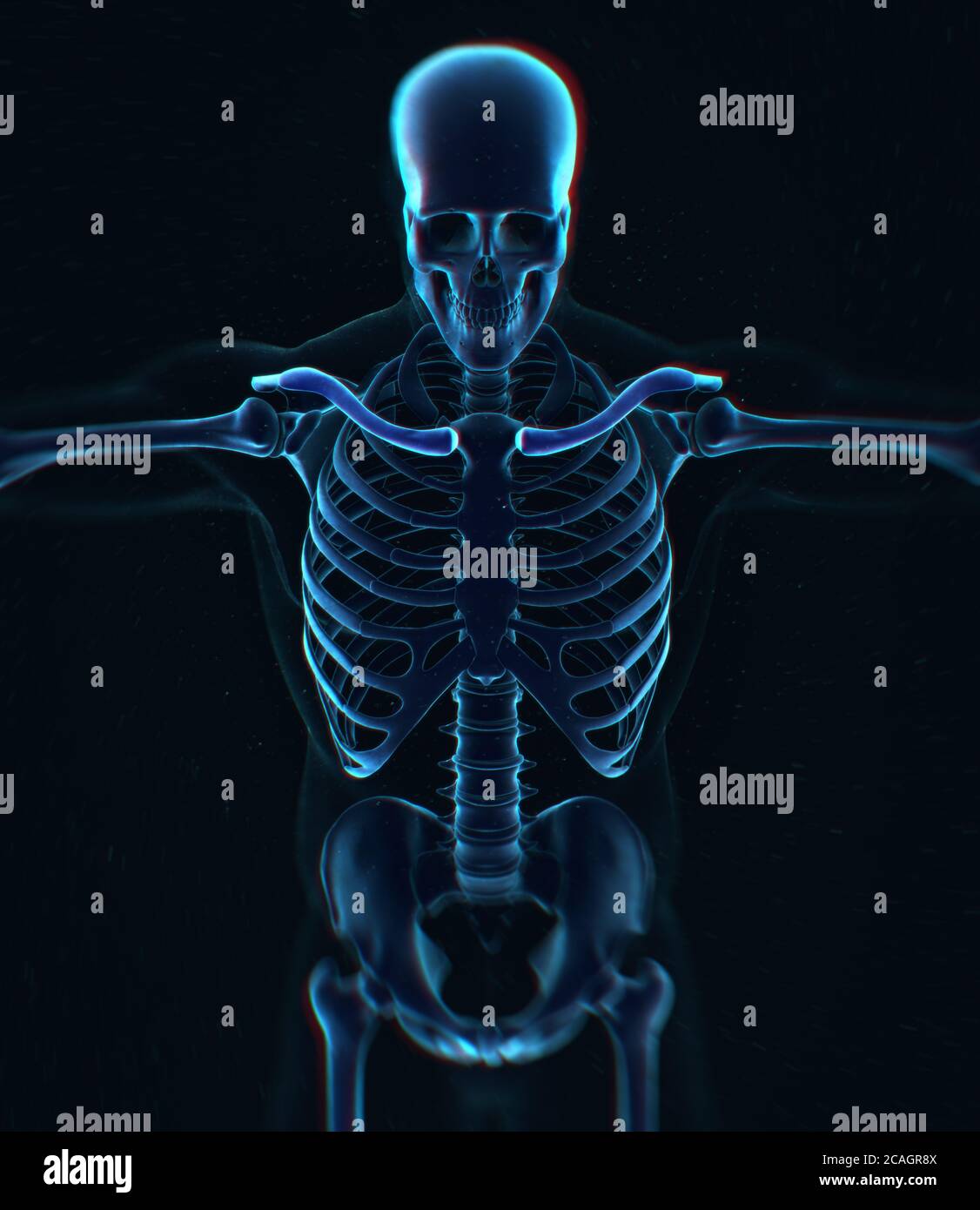 Collarbone x ray hires stock photography and images Alamy