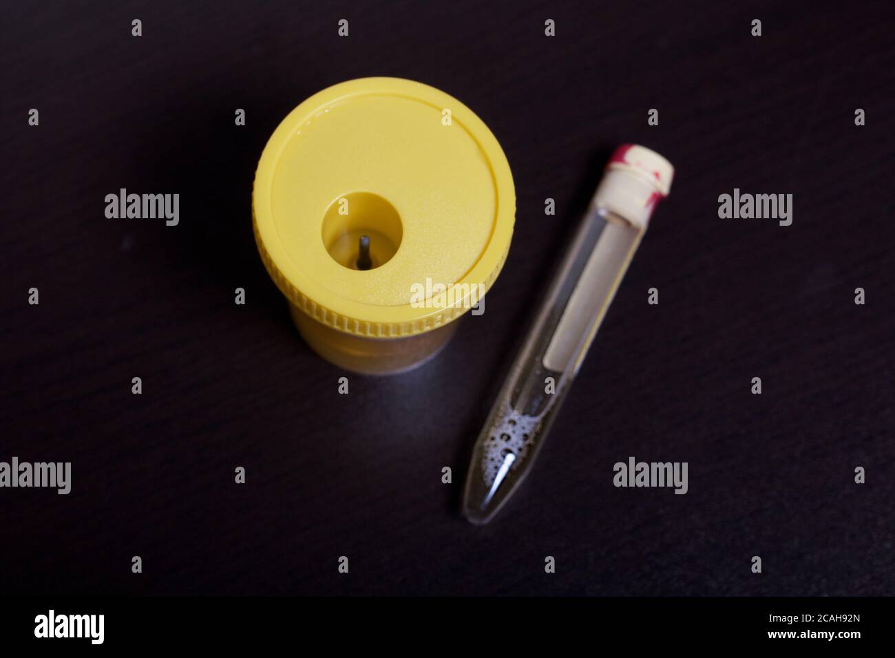 Urine in test container and vacuum tube. Disposable medical polymeric