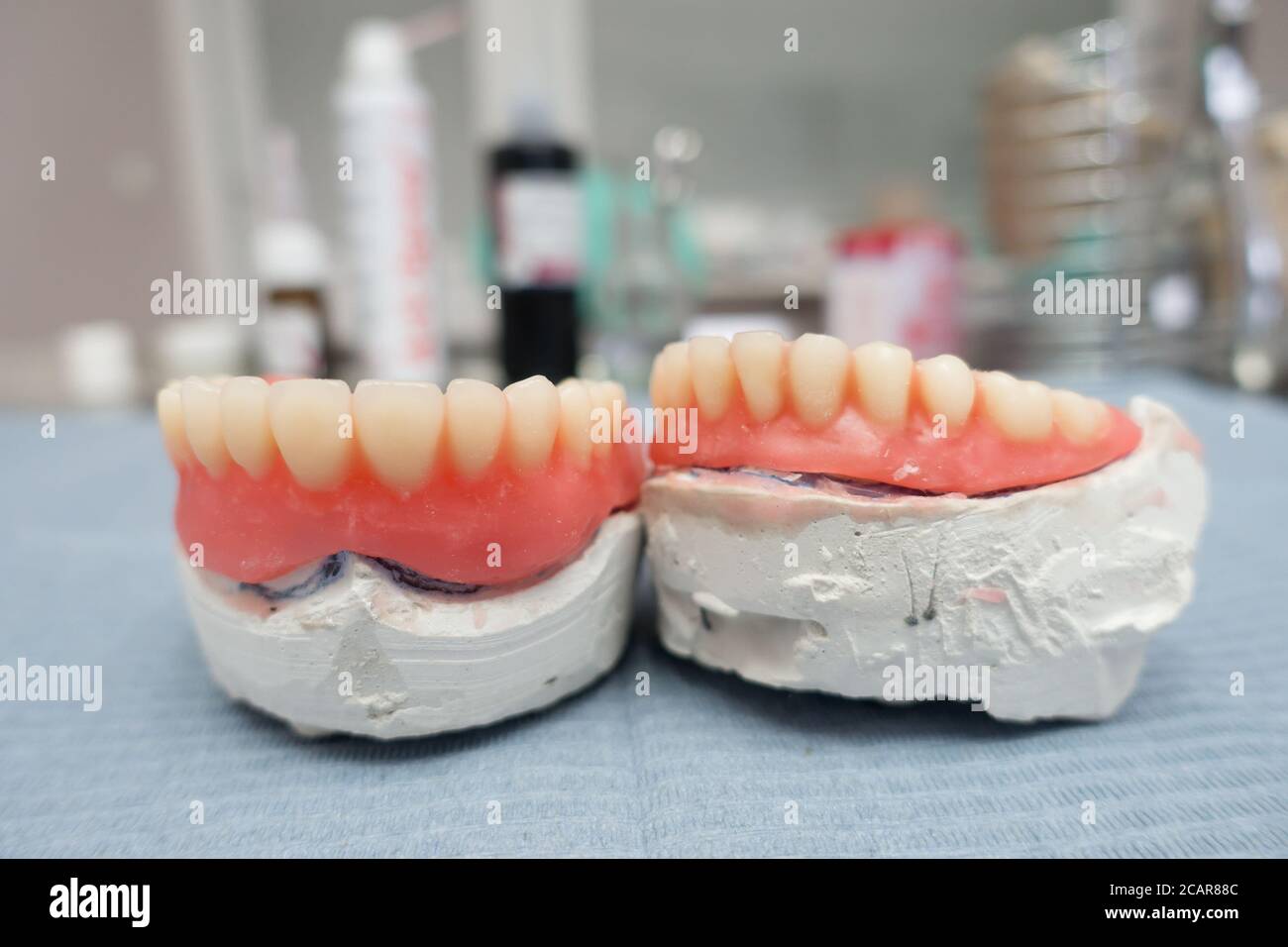 complete removable dental prostheses on gypsum models in the