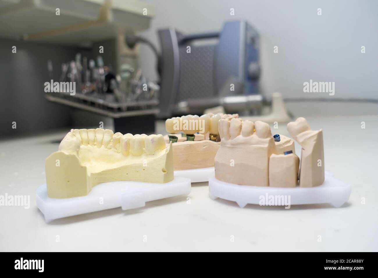 zirconia dental crowns on dental models in the dental laboratory Stock