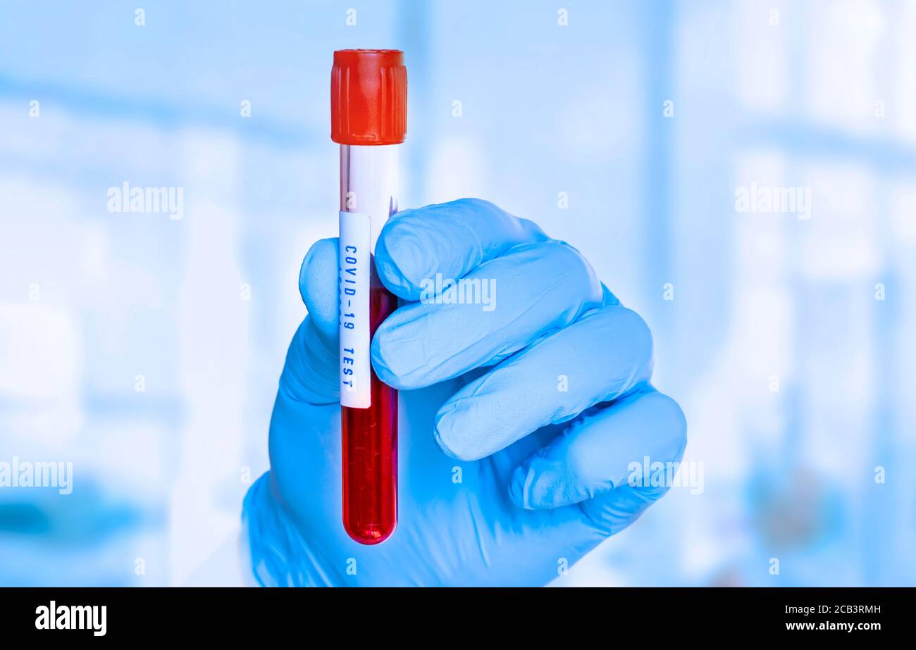 Blood test poster hires stock photography and images Alamy