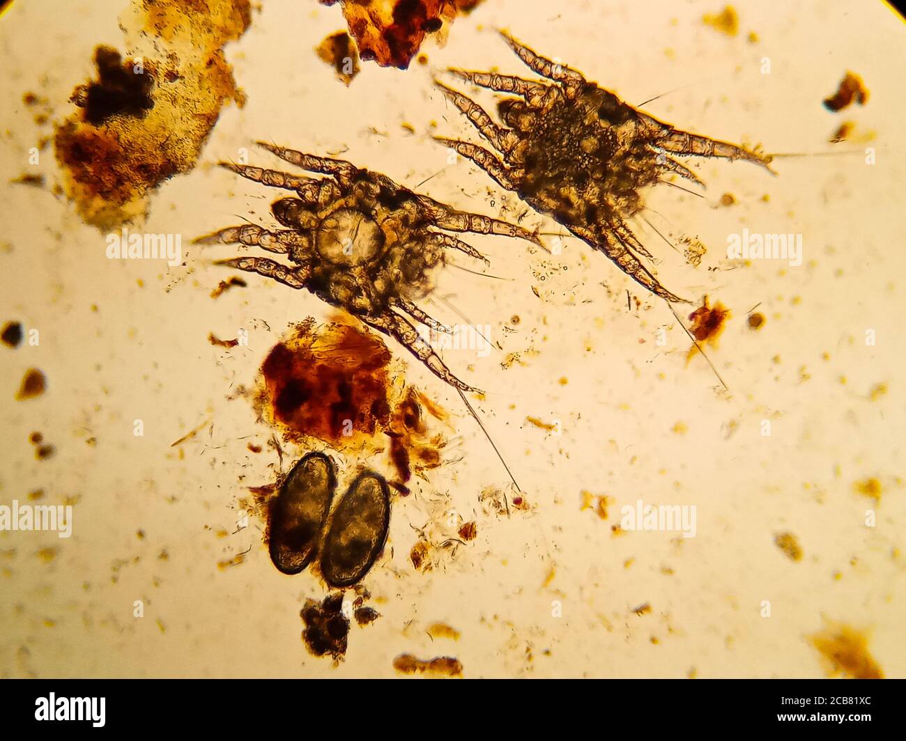 Ear Mite From A Cat Under The Microscope Stock Photo Alamy cure-for-ear-mites-best-sale-in-cats