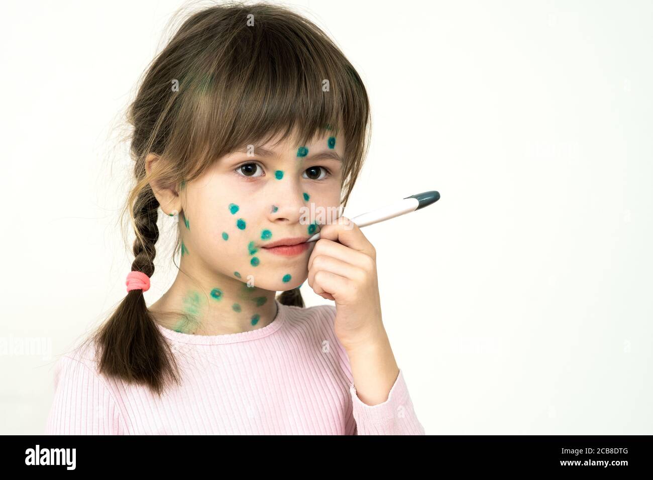 Child girl covered with green rashes on face ill with chickenpox, measles or rubella virus holding medical thermometer in her mouth having high temper Stock Photo