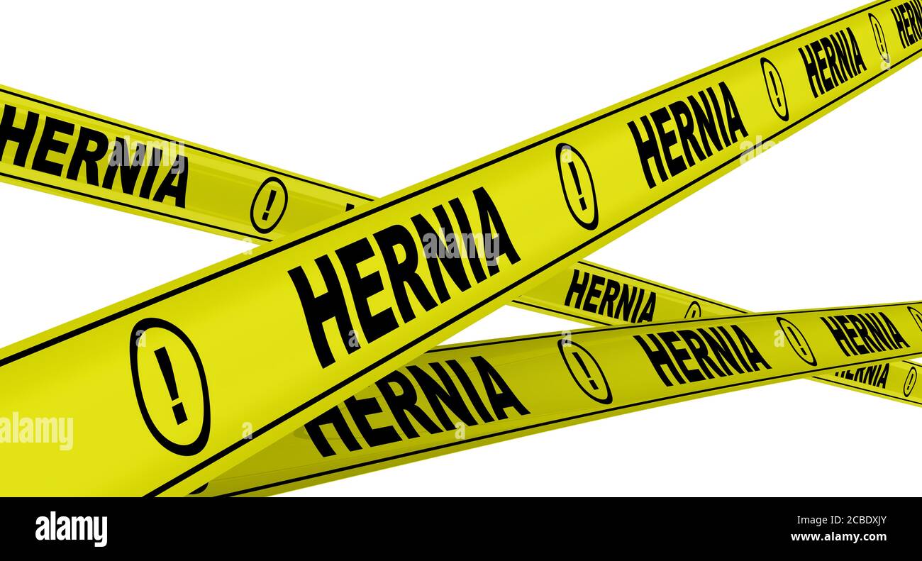 Hernia. Yellow warning tapes with black words HERNIA (is the abnormal