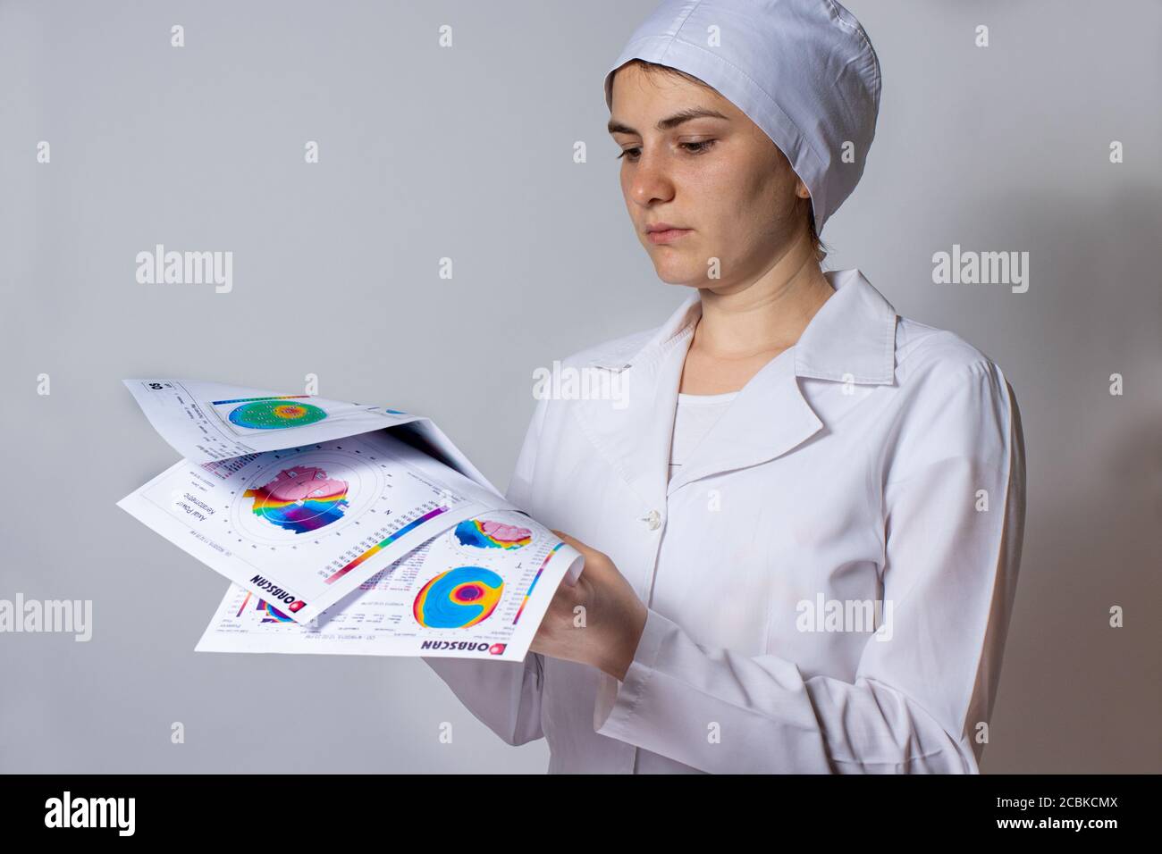 Thinning corneal dystrophy, eye keratotopography. Stock Photo