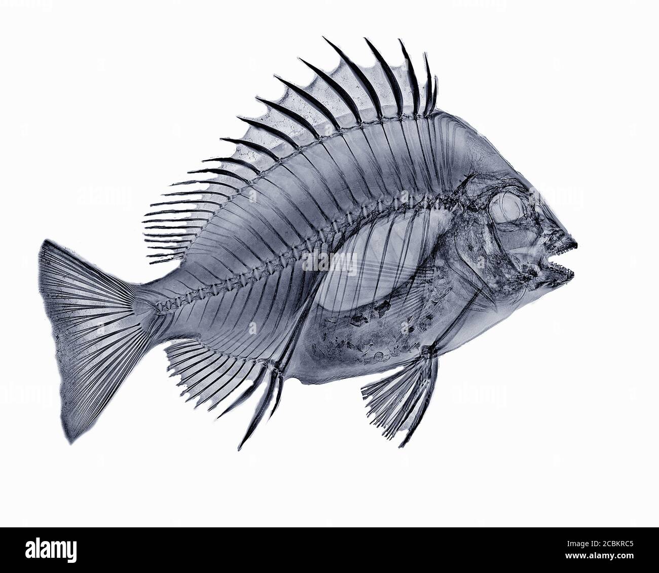 X-ray image of sheephead fish Stock Photo